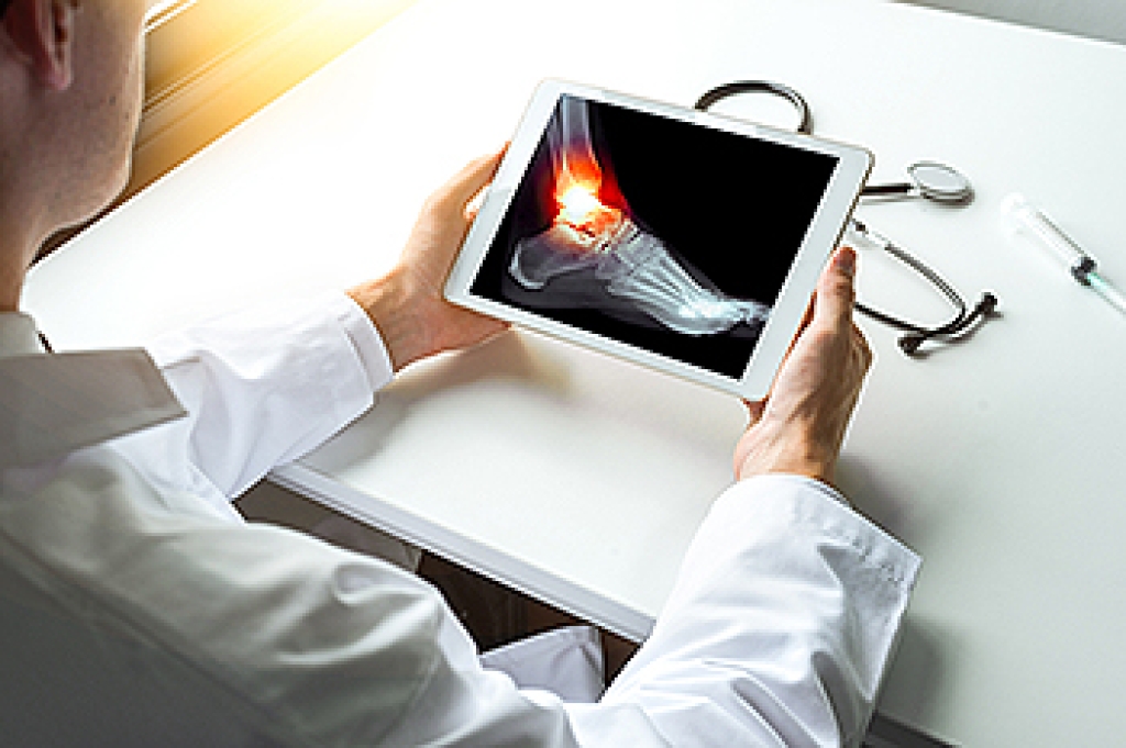What Is an Isolated Medial Malleolar Fracture?