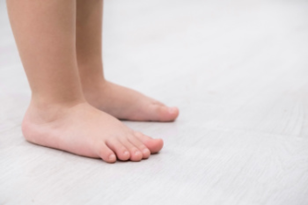 Childhood Flat Feet