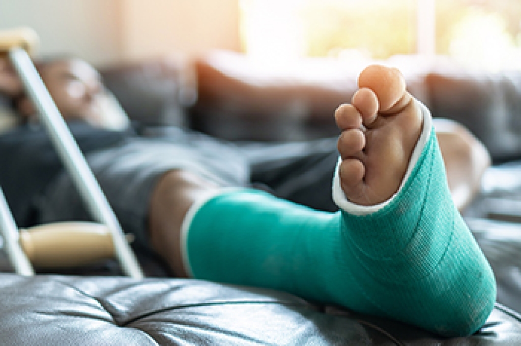 Types and Causes of Ankle Fractures