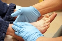 Why Diabetic Foot Care Matters