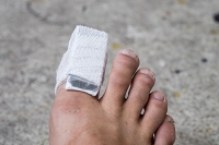 Managing a Broken Toe